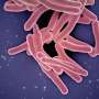 scientists-uncover-how-tb-manipulates-immune-system-to-infect