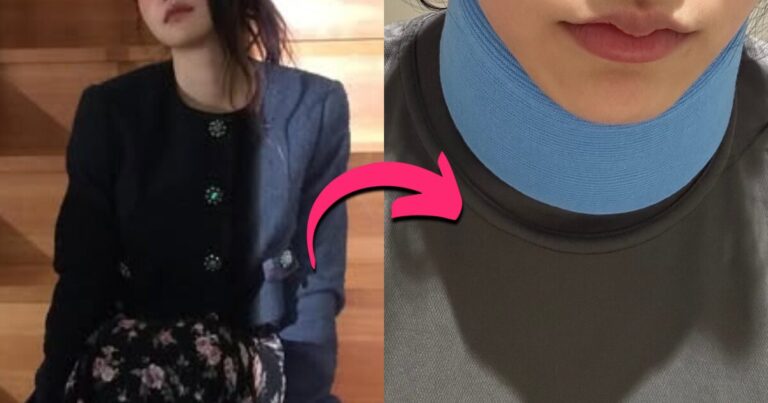 yeri-of-red-velvet-suffers-neck-injury-during-pilates-session