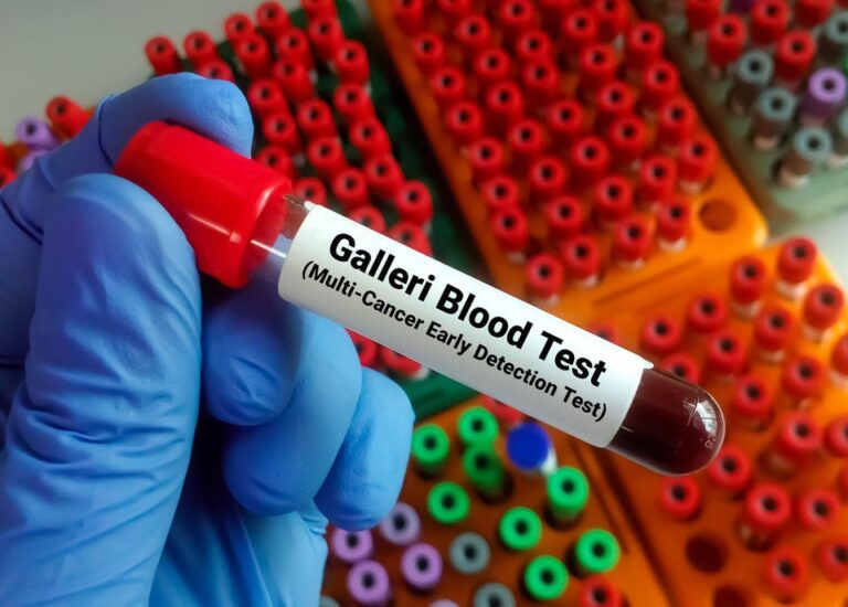 is-the-galleri-cancer-test-a-smart-choice-for-you-