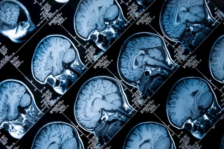 personalised-medicine-faces-challenges-despite-hype-and-potential