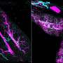 researchers-uncover-nervous-system-s-role-in-pancreatic-cancer